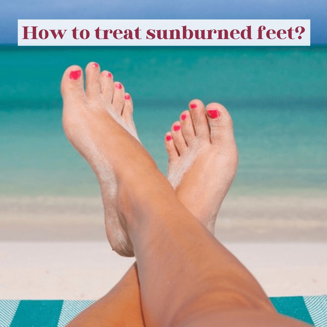 How to treat sunburned feet? - LuxaDerme