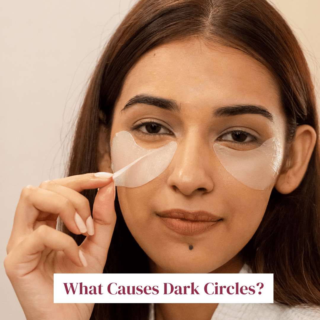 What causes dark circles? - LuxaDerme