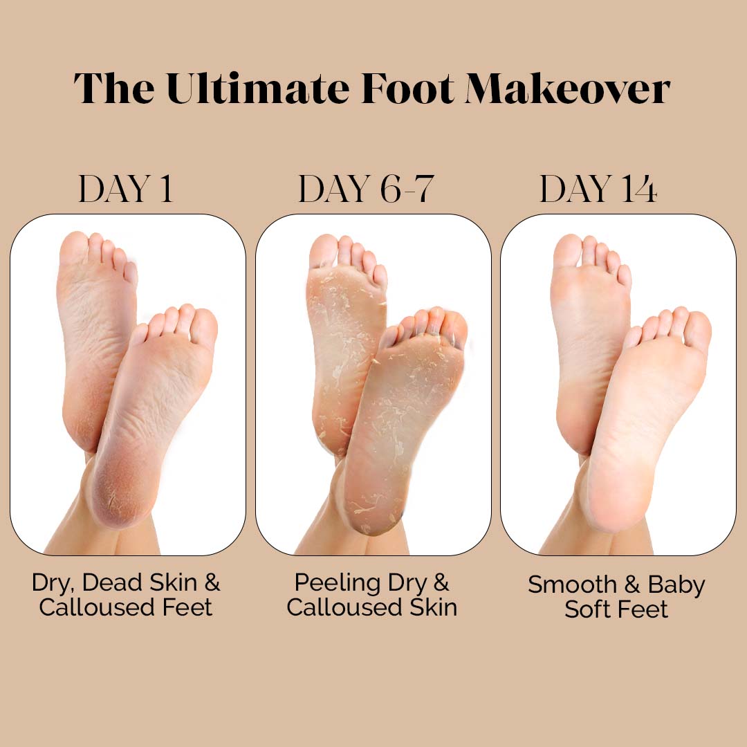Peeling & Exfoliating - LuxaDerme_1