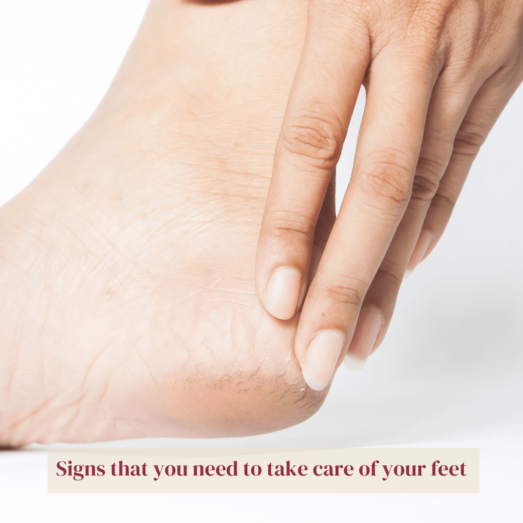 Signs that you need to take care of your feet - LuxaDerme