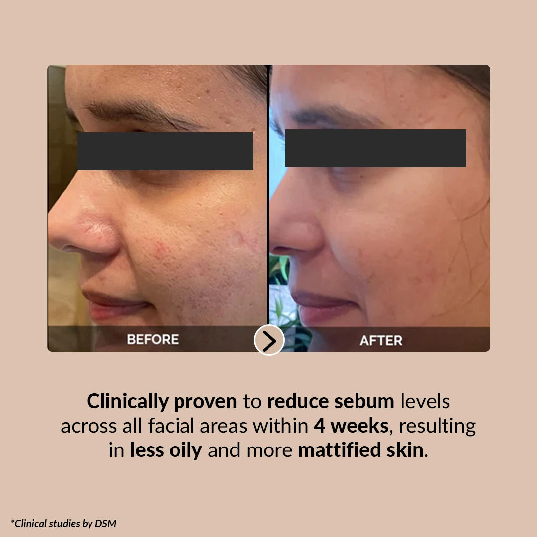 Pore Perfecting Serum