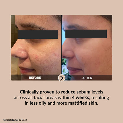 Pore Perfecting Serum