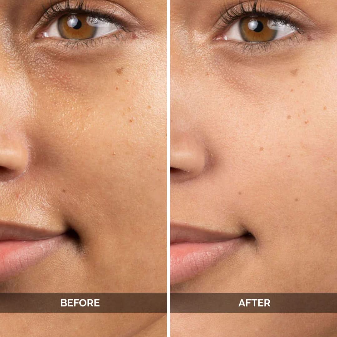 Ultra_Brightening_Serum_5_luxaderme_korean_skincare