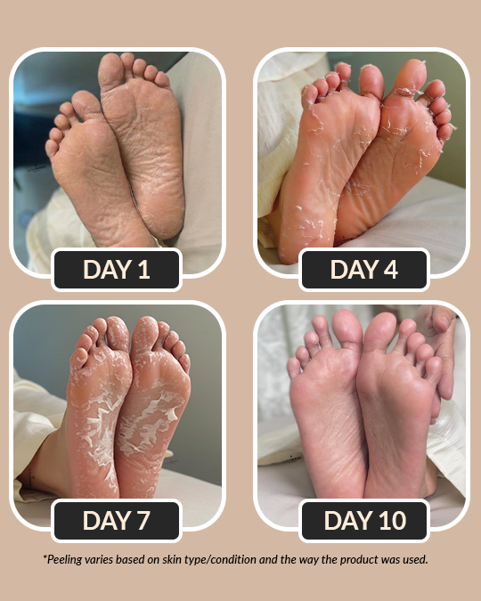 Foot Peeling Mask